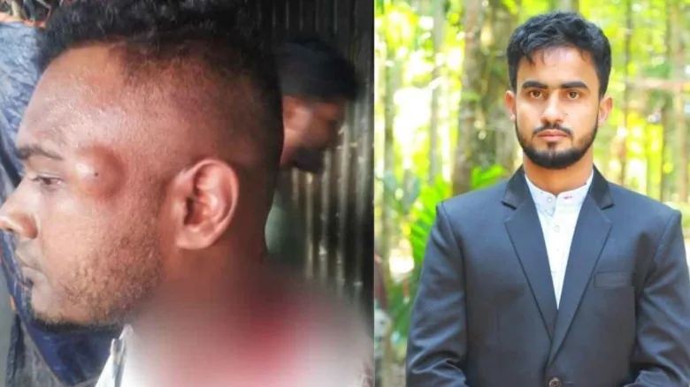 এতিমের টাকা আত্মসাত করলেন ছাত্রদল সভাপতি, মুখ খোলায় কর্মীকে কুপিয়ে রক্তাক্ত!
