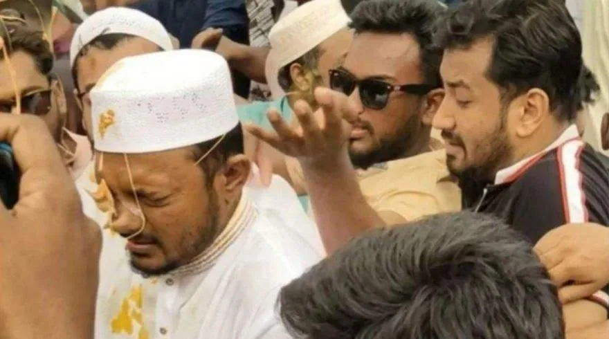 ডিম চোখে এসে লাগার পর অন্ধকার দেখছিলাম: নাসীরুদ্দীন পাটওয়ারী