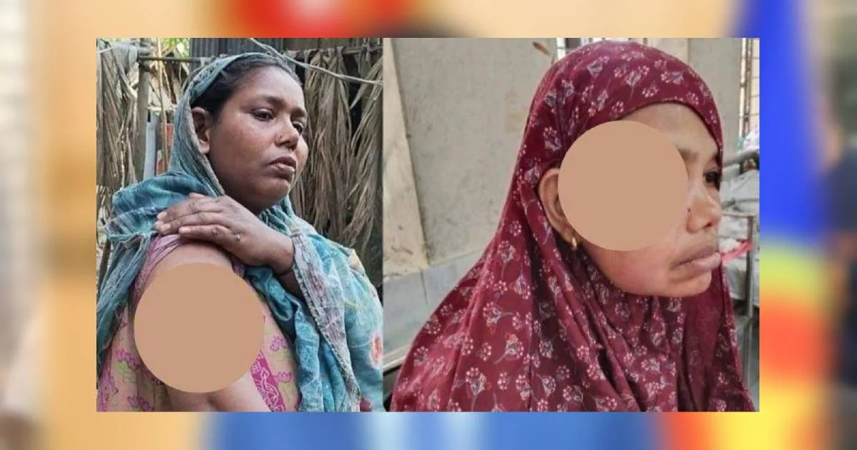 দাঁড়িপাল্লায় ভোট: বিএনপি নেতার নেতৃত্বে তিন নারীকে পিটিয়ে জখম