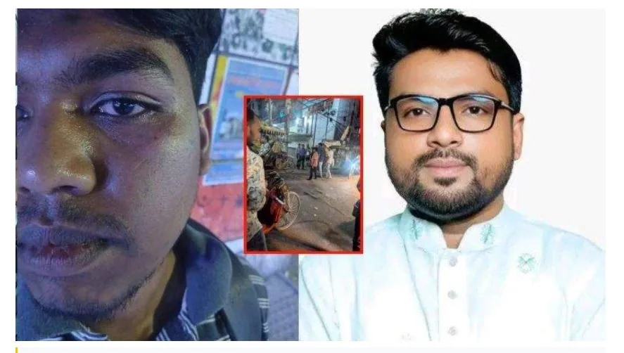 ‘ঢাকা বিশ্ববিদ্যালয় ছাত্র পরিচয় দিলে আরও বেশি মারধর করেন ছাত্রদল নেতা’