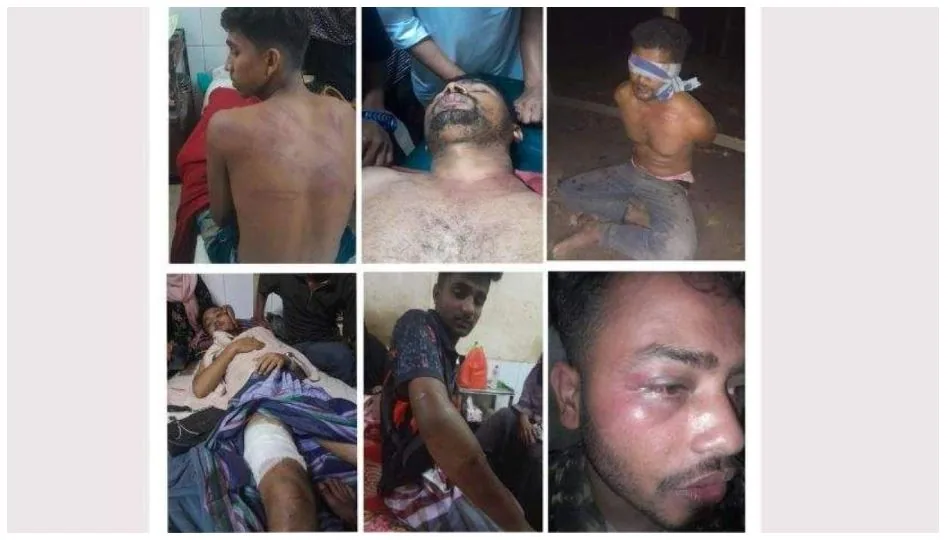 ‘মধ্যযুগীয় কায়দায়’ ছাত্রদলের ৮ নেতাকর্মীকে নির্যাতন, অভিযোগ বিএনপি নেতাদের বিরুদ্ধে