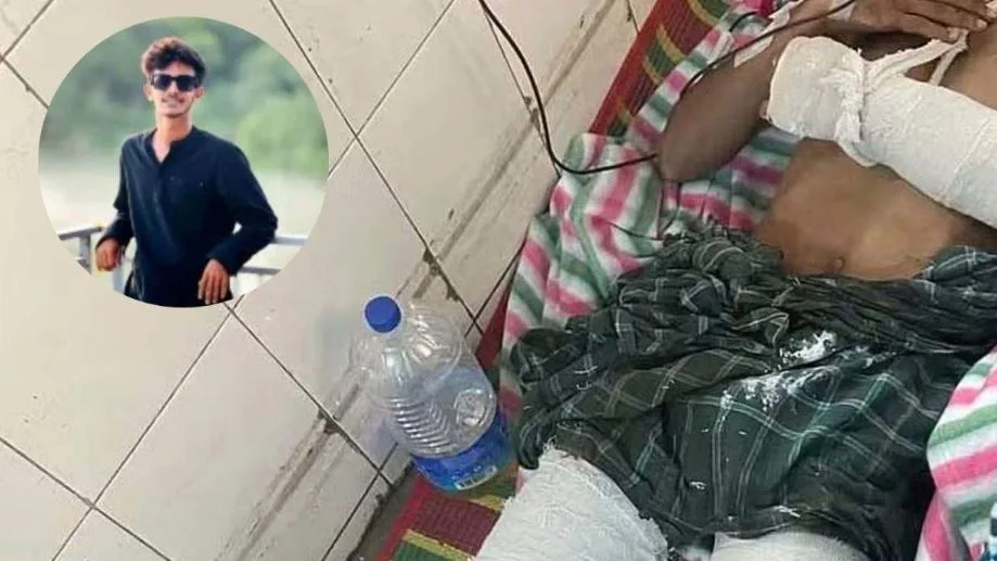 নিষিদ্ধ ছাত্রলীগ নেতার হাত-পায়ের রগ কর্তন, অভিযোগ ছাত্রদলের বিরুদ্ধে